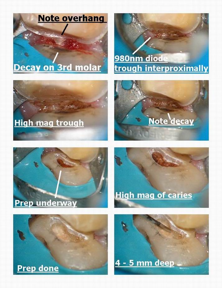 Resize of Troughing on deep distal pg 2.jpg